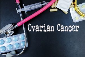 Researchers Identified 12 New Genetic Variants Associated With Ovarian Cancer