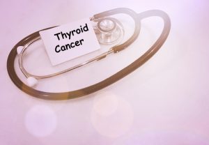 MSK’s Approach Matches Thyroid Cancer Screening